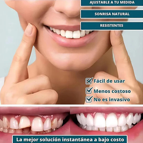 [COMPRÁ 1 Y LLEVÁ 2] - Smile Pro® - Carillas Dentales Removibles | Inferior y Superior