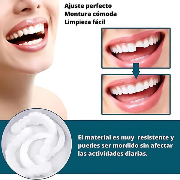 [COMPRÁ 1 Y LLEVÁ 2] - Smile Pro® - Carillas Dentales Removibles | Inferior y Superior